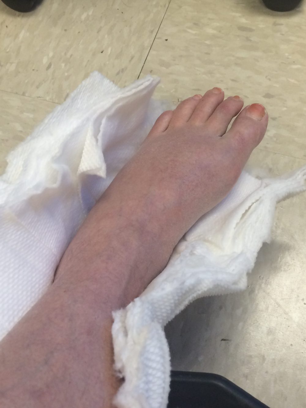 broken?